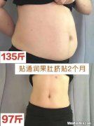 通润果肚脐贴有用吗,肚脐贴减肥有效果吗